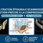 Infiltration Épidurale Scannoguidée à Inezgane | CIM Inezgane